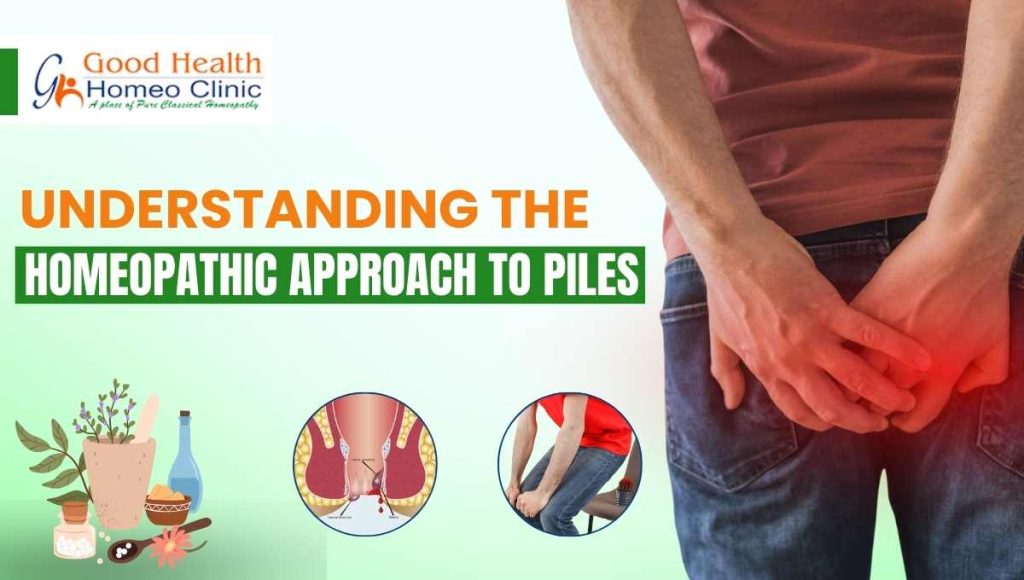 Understanding the Homeopathic Approach to Piles